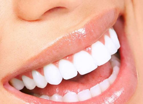 Răng sứ mang đến diện mạo mới cho nụ cười xinh