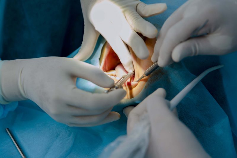 Phẫu thuật đặt trụ Implant