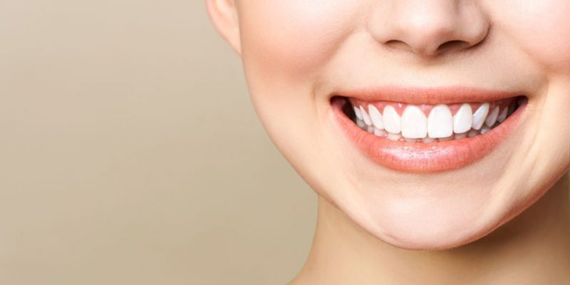 Tự tin hơn với nụ cười mới